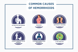 Infographic showing common causes of hemorrhoids, including straining, and pregnancy